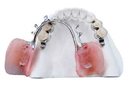 tandpand-reuver-dental-unique-ceka-attachment