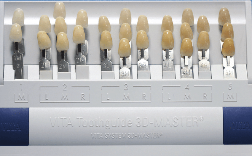 tandpand-reuver-volledige-prothese-vita-toothguide-3d-master-r-shade-guide